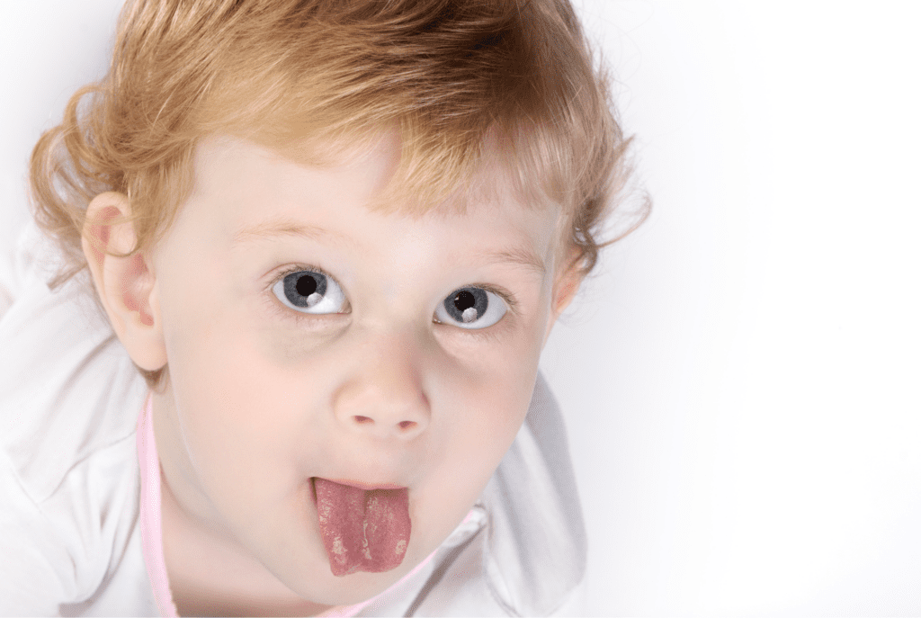 LongTerm Effects of Tongue Tie Thrive Little